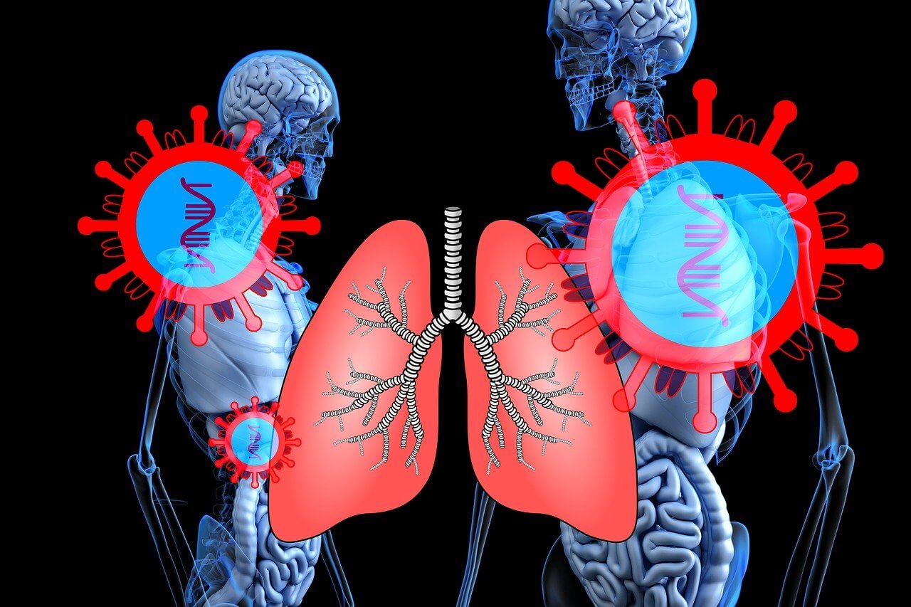 AI Analyzing Lung X-Rays For Early Cancer Detection