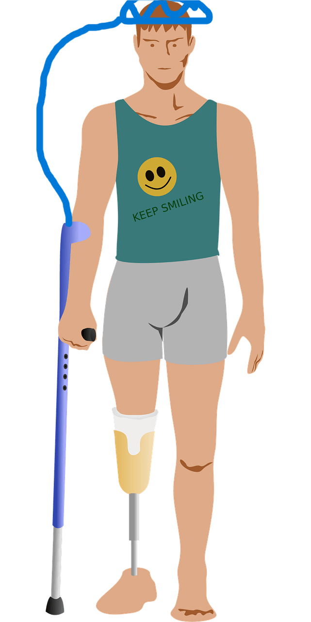 Mind Controlled Prosthetic Helping User Walk